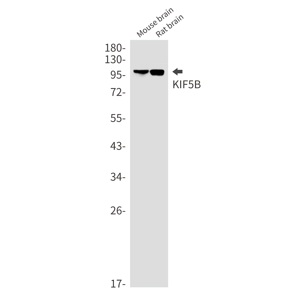 KIF5B Rabbit mAb ABZ2559