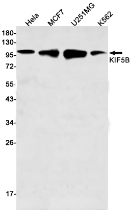 KIF5B Rabbit mAb ABZ2559