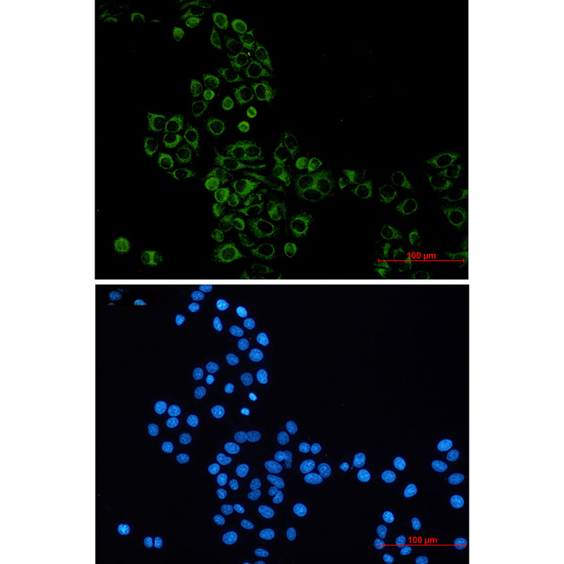 GBP1 Rabbit mAb ABZ2560