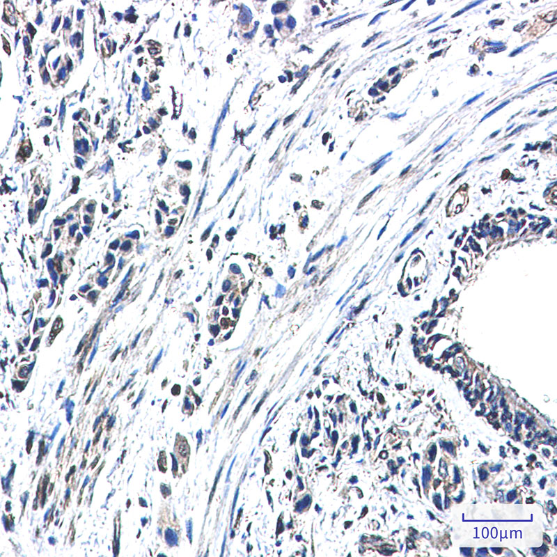 GBP1 Rabbit mAb ABZ2560