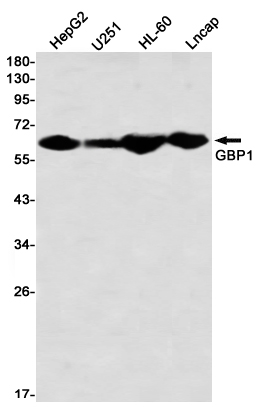 GBP1 Rabbit mAb ABZ2560