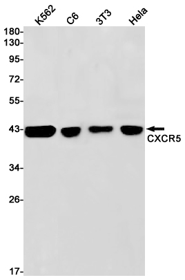 CXCR5 Rabbit mAb ABZ2561