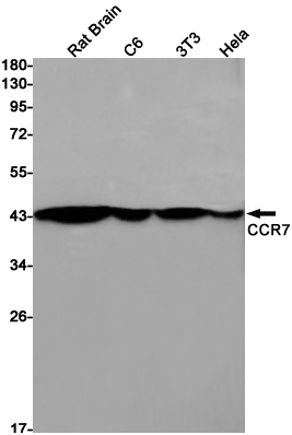 CCR7 Rabbit mAb ABZ2562
