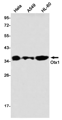 OTX1 Rabbit mAb ABZ2563