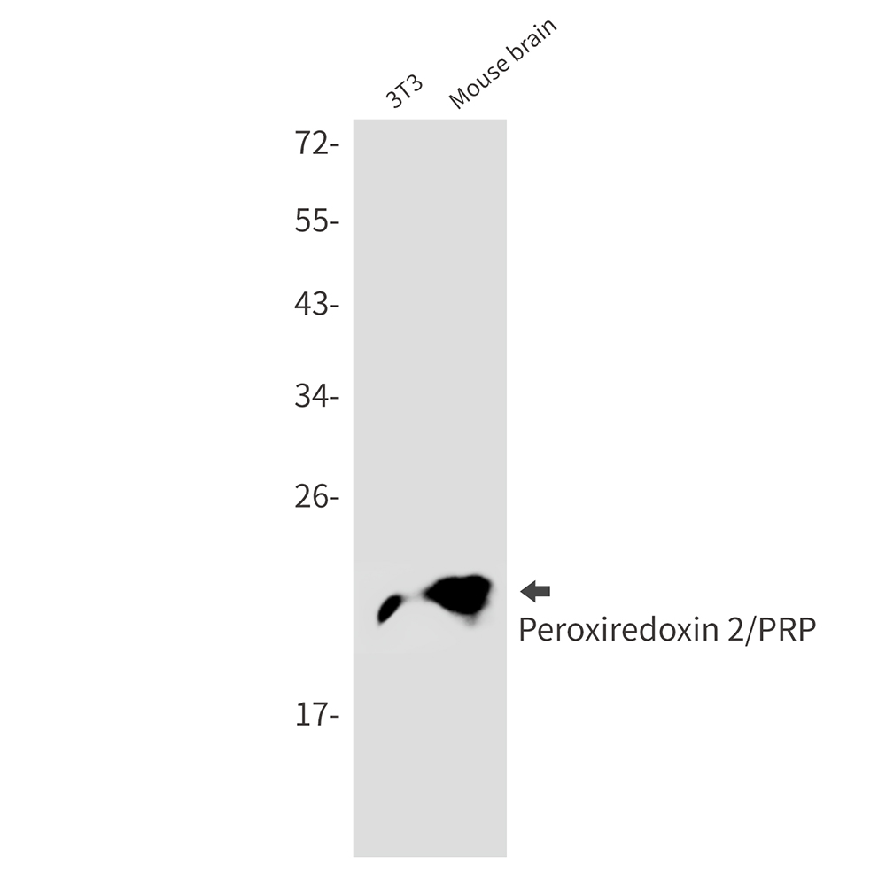 Peroxiredoxin 2 Rabbit mAb ABZ2565
