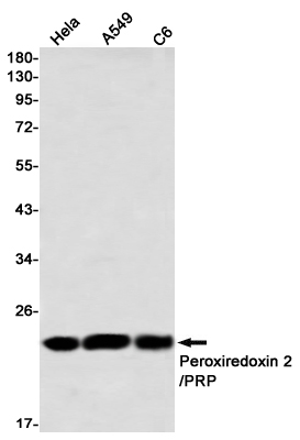 Peroxiredoxin 2 Rabbit mAb ABZ2565
