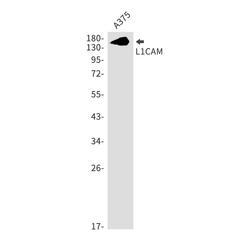 L1CAM Rabbit mAb ABZ2566