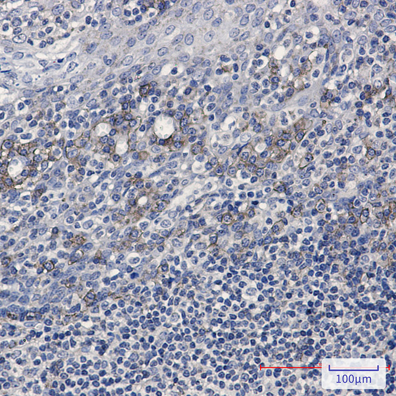 CD32B Rabbit mAb ABZ2567