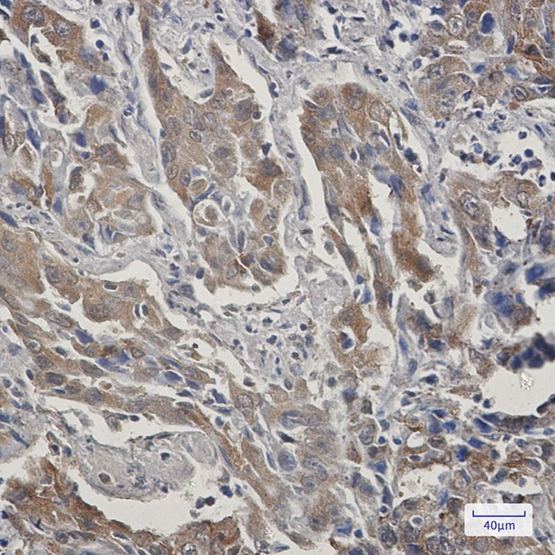 STIP1/STI1 Rabbit mAb ABZ2568