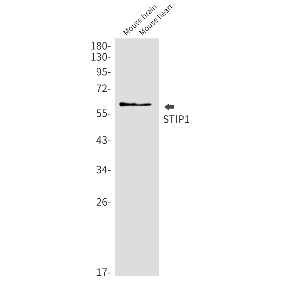 STIP1/STI1 Rabbit mAb ABZ2568