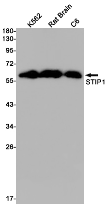 STIP1/STI1 Rabbit mAb ABZ2568