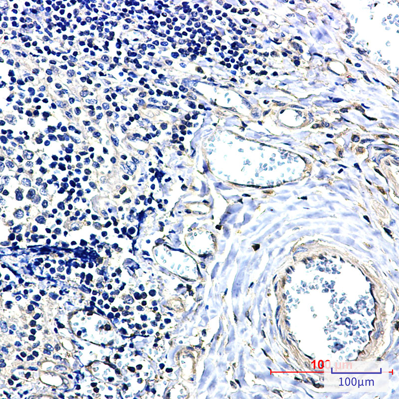14-3-3 alpha/beta Rabbit mAb ABZ2569