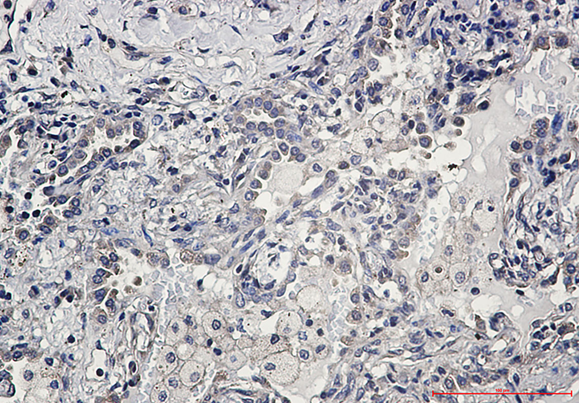 AKT1/2/3 Rabbit mAb ABZ2570