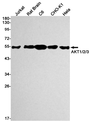 AKT1/2/3 Rabbit mAb ABZ2570