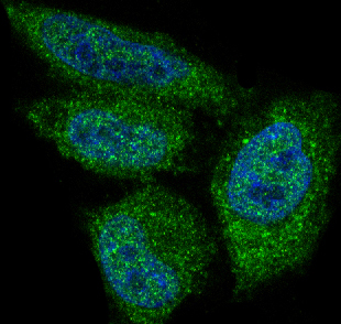 AKT1 Rabbit mAb ABZ2571
