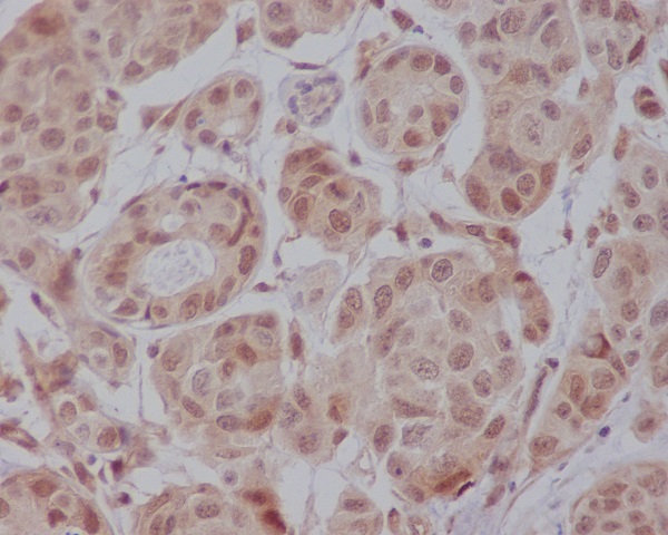 AKT1 Rabbit mAb ABZ2571