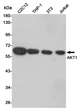 AKT1 Rabbit mAb ABZ2571