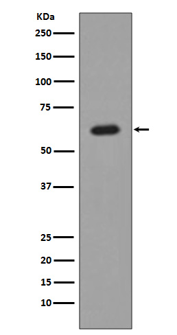 AKT1 Rabbit mAb ABZ2571