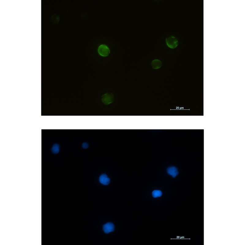 RRM2 Rabbit mAb ABZ2574