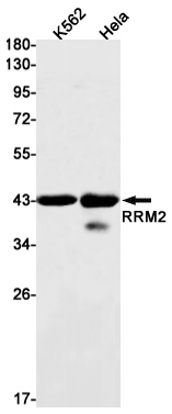 RRM2 Rabbit mAb ABZ2574