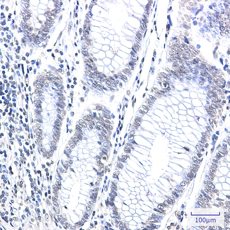 CPS1 Rabbit mAb ABZ2575