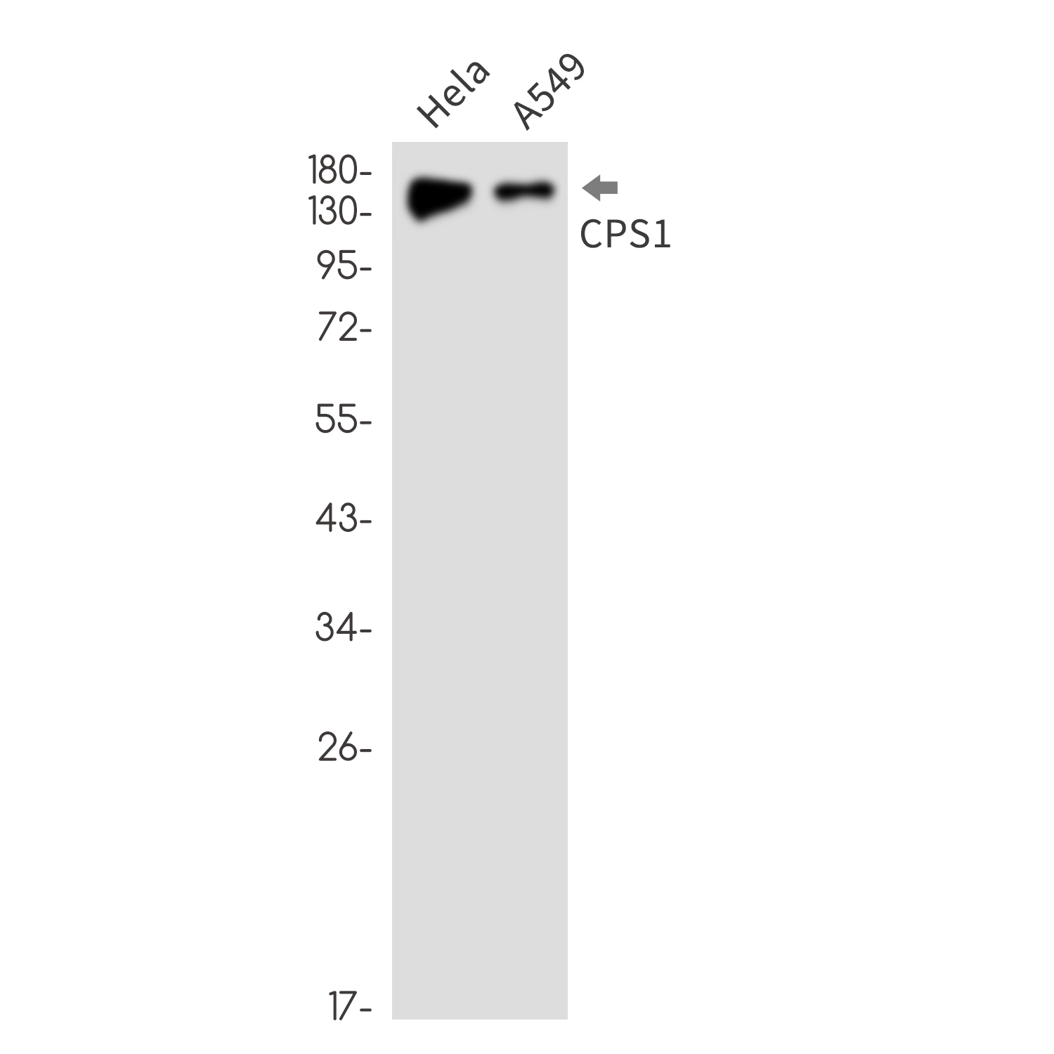 CPS1 Rabbit mAb ABZ2575