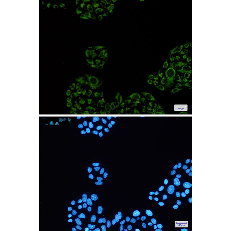 SDHA Rabbit mAb ABZ2576