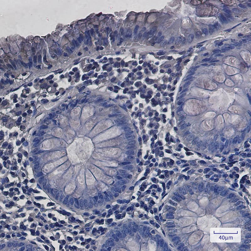 SDHA Rabbit mAb ABZ2576