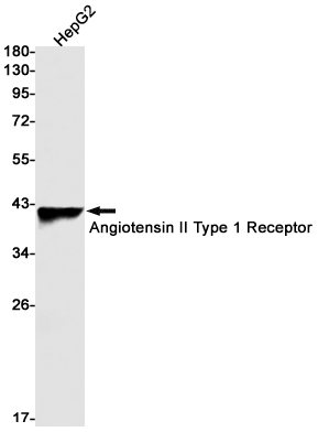 Angiotensin II Type 1 Receptor Rabbit mAb ABZ2578