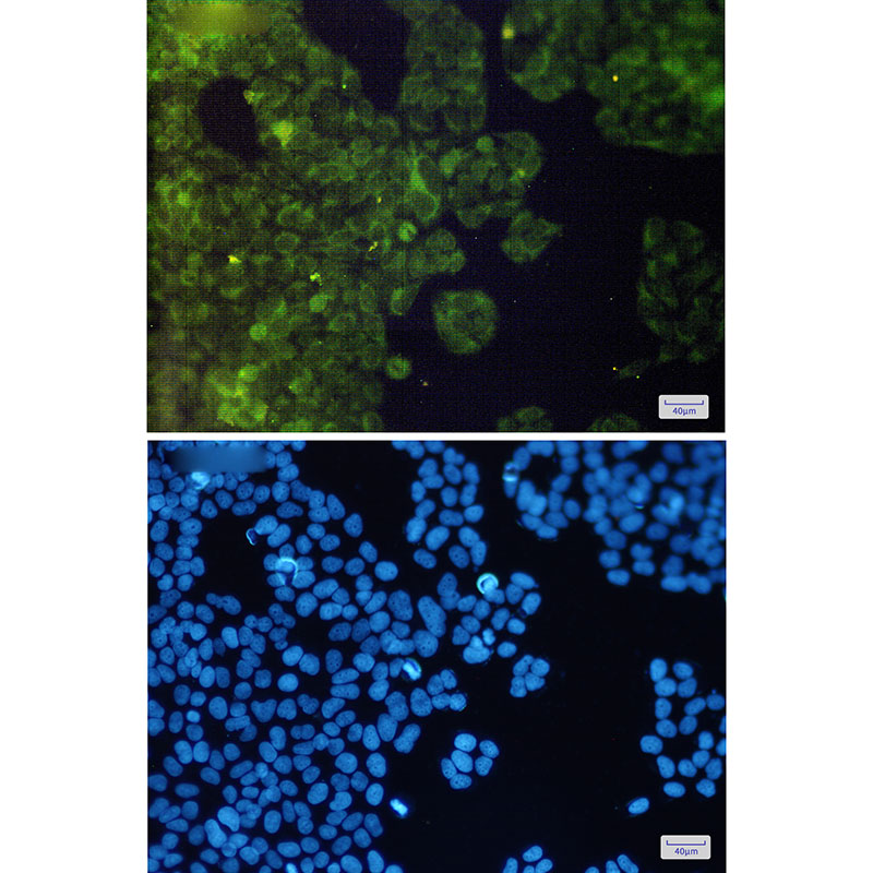 AdSS 2 Rabbit mAb ABZ2580