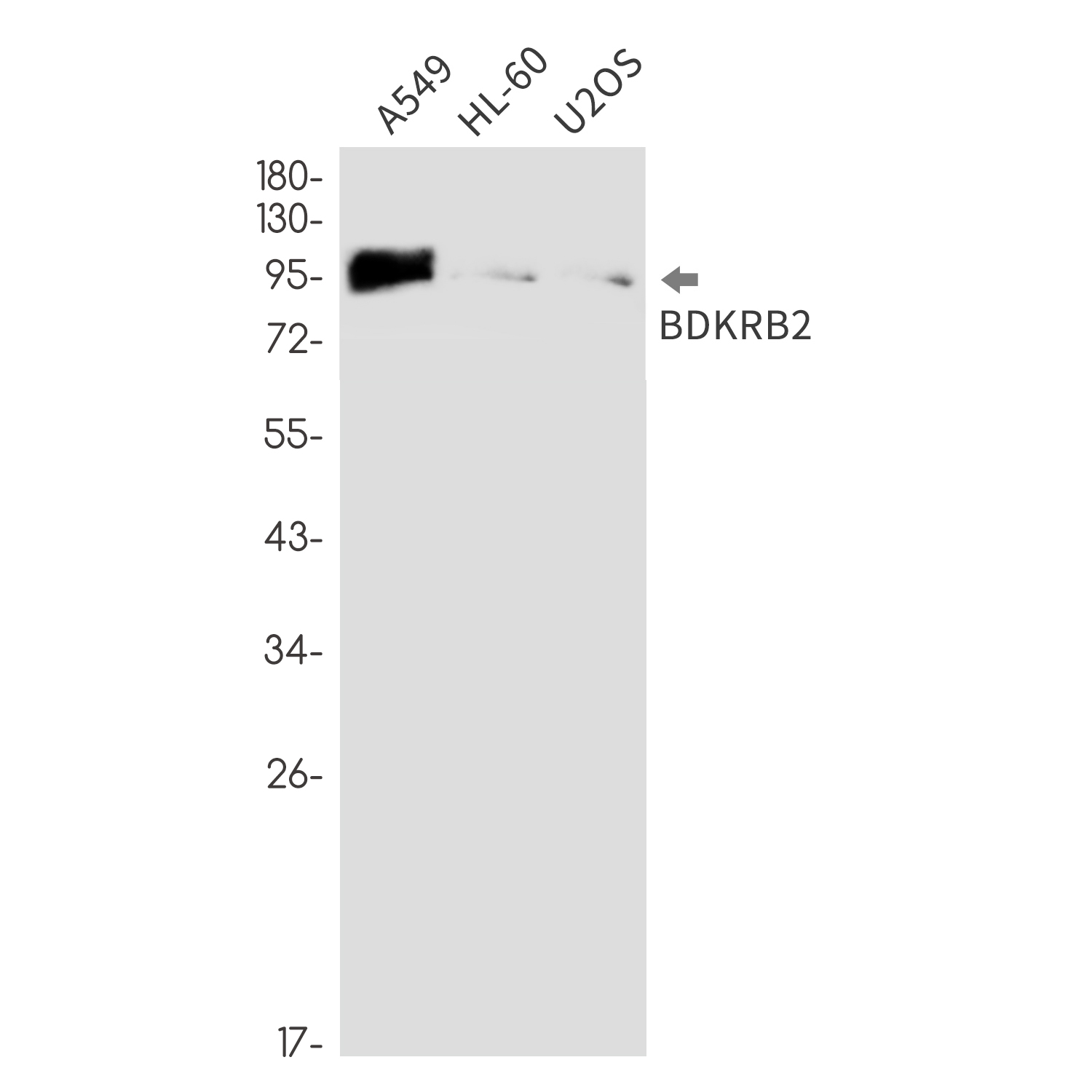 B2R Rabbit mAb ABZ2581