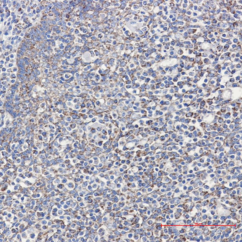 Cyclophilin F Rabbit mAb ABZ2582