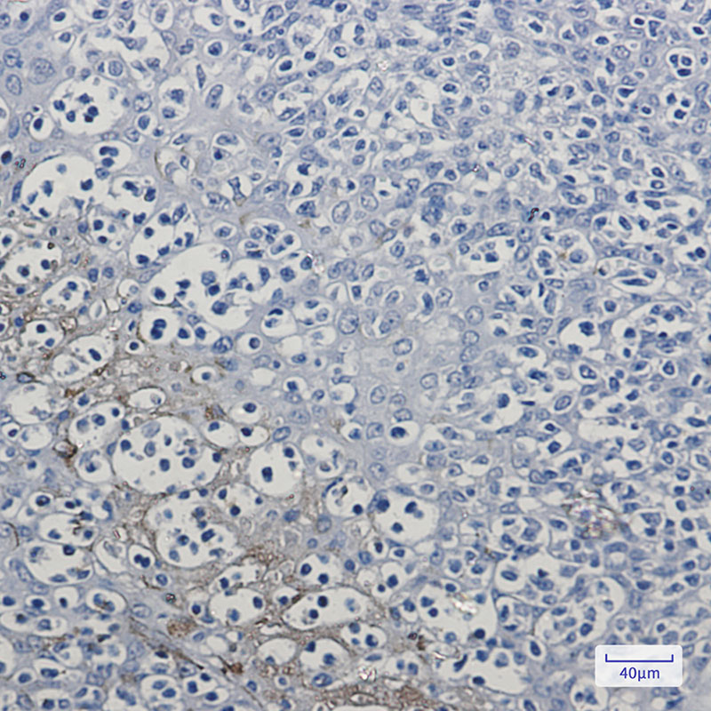 RKIP Rabbit mAb ABZ2583