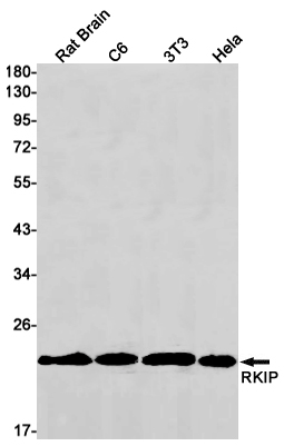 RKIP Rabbit mAb ABZ2583