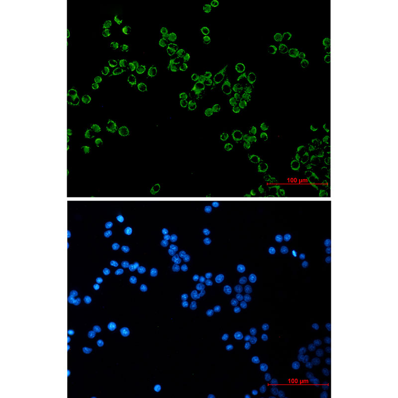Peroxiredoxin 3/PRDX3 Rabbit mAb ABZ2584