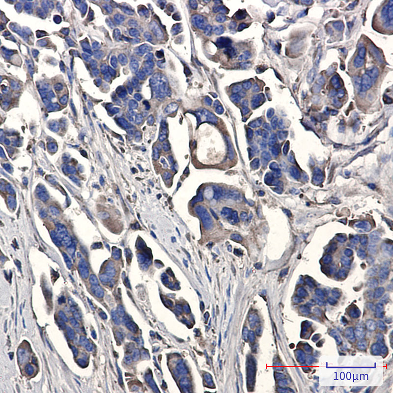 Peroxiredoxin 3/PRDX3 Rabbit mAb ABZ2584