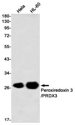 Peroxiredoxin 3/PRDX3 Rabbit mAb ABZ2584