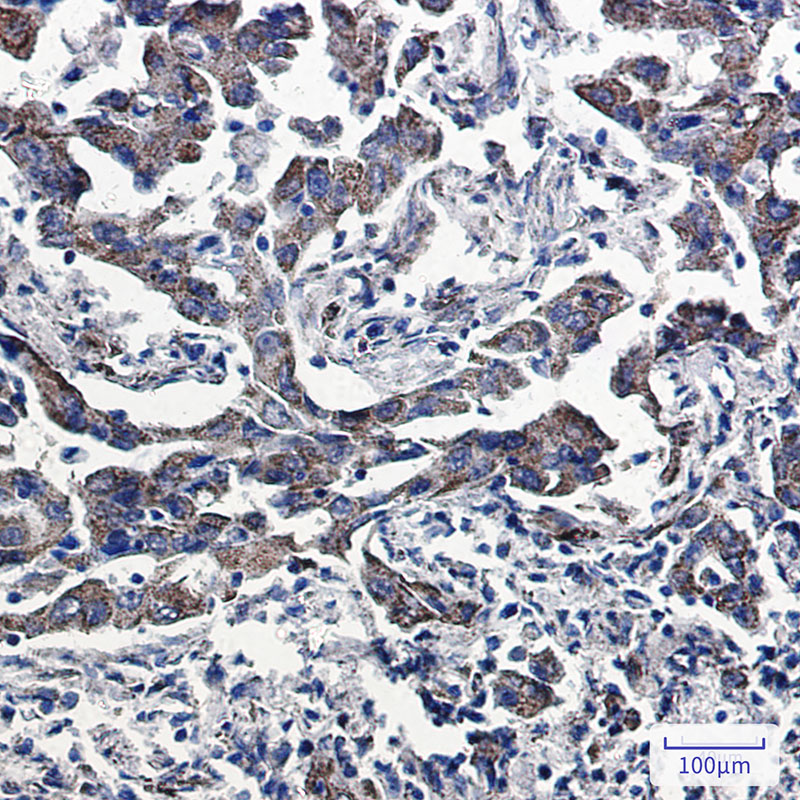 Peroxiredoxin 5 Rabbit mAb ABZ2585