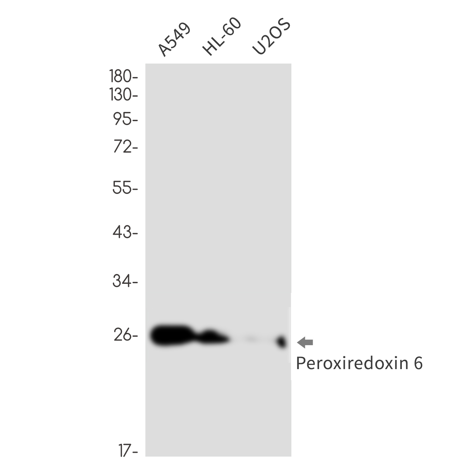 Peroxiredoxin 6 Rabbit mAb ABZ2586