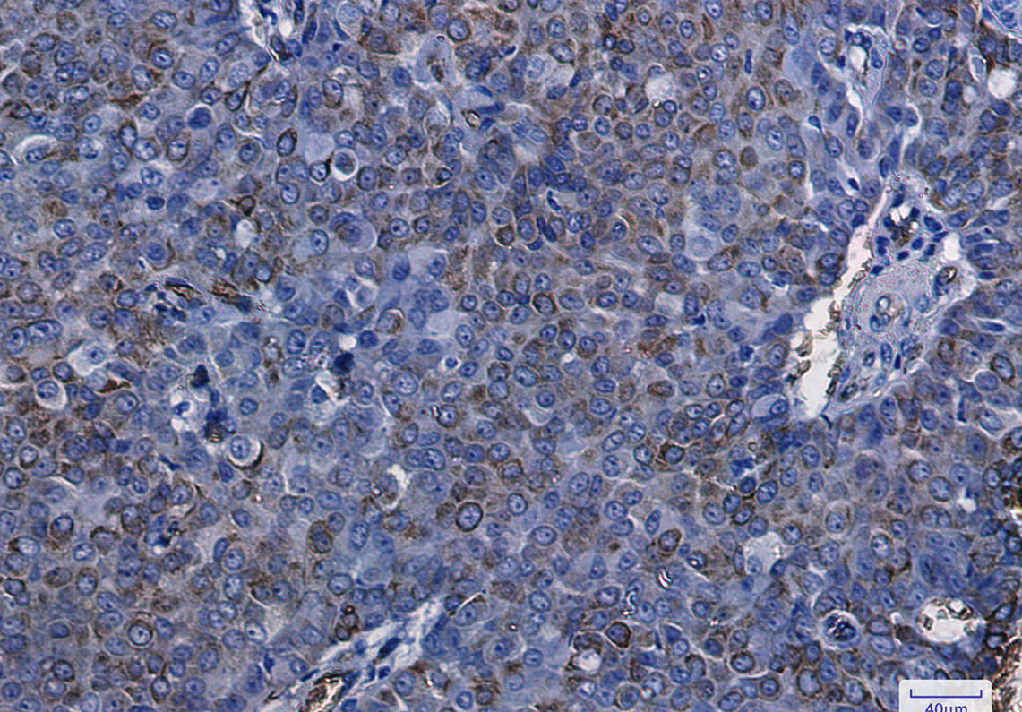 Aquaporin 1 Rabbit mAb ABZ2587