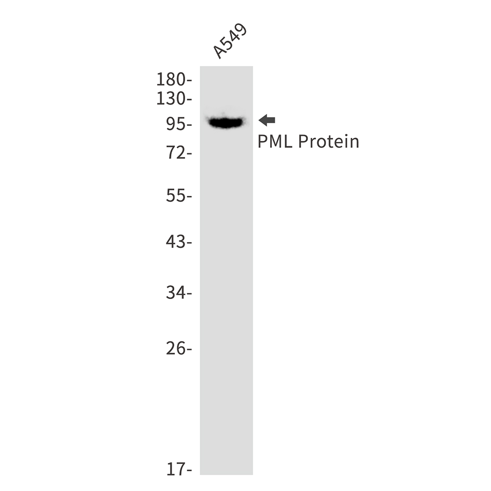 PML Protein Rabbit mAb ABZ2588