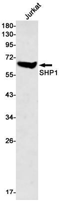 SHP1 Rabbit mAb ABZ2591