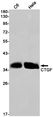 CTGF Rabbit mAb ABZ2593