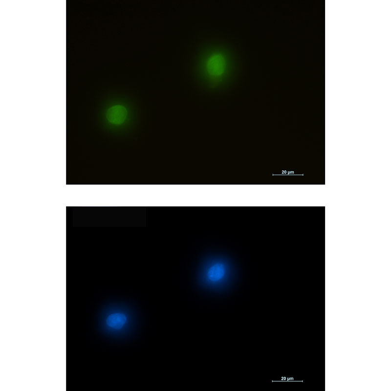 ERK2 Rabbit mAb ABZ2594