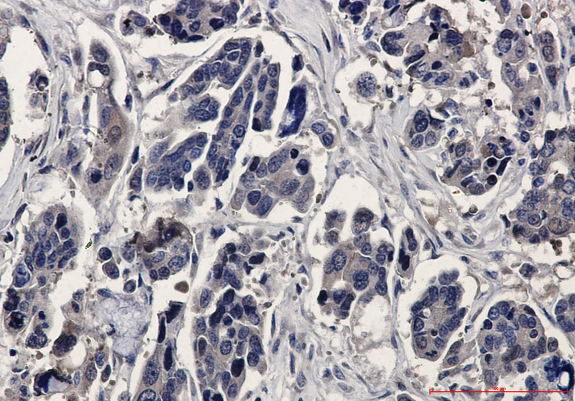 ERK2 Rabbit mAb ABZ2594