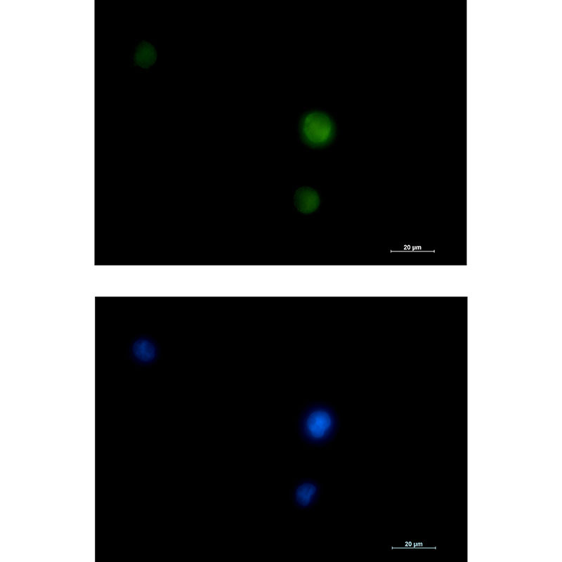 ERK1/2 Rabbit mAb ABZ2595