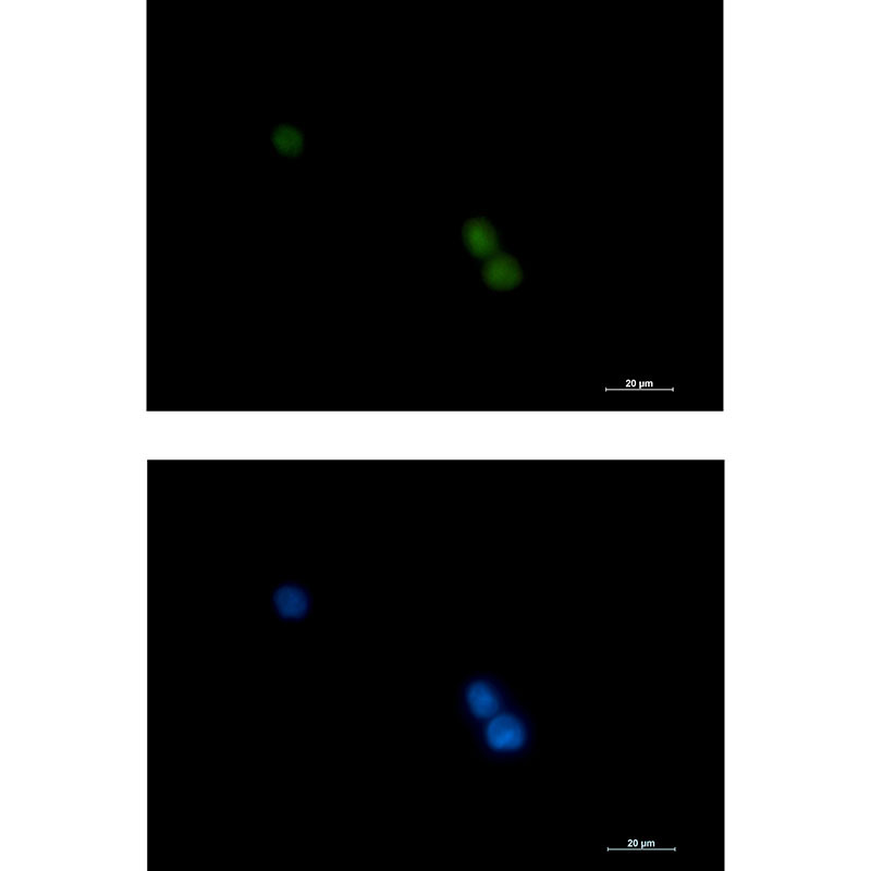 POLD1 Rabbit mAb ABZ2597