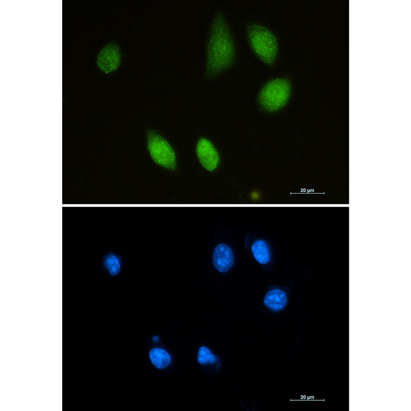Choline Acetyltransferase Rabbit mAb ABZ2598