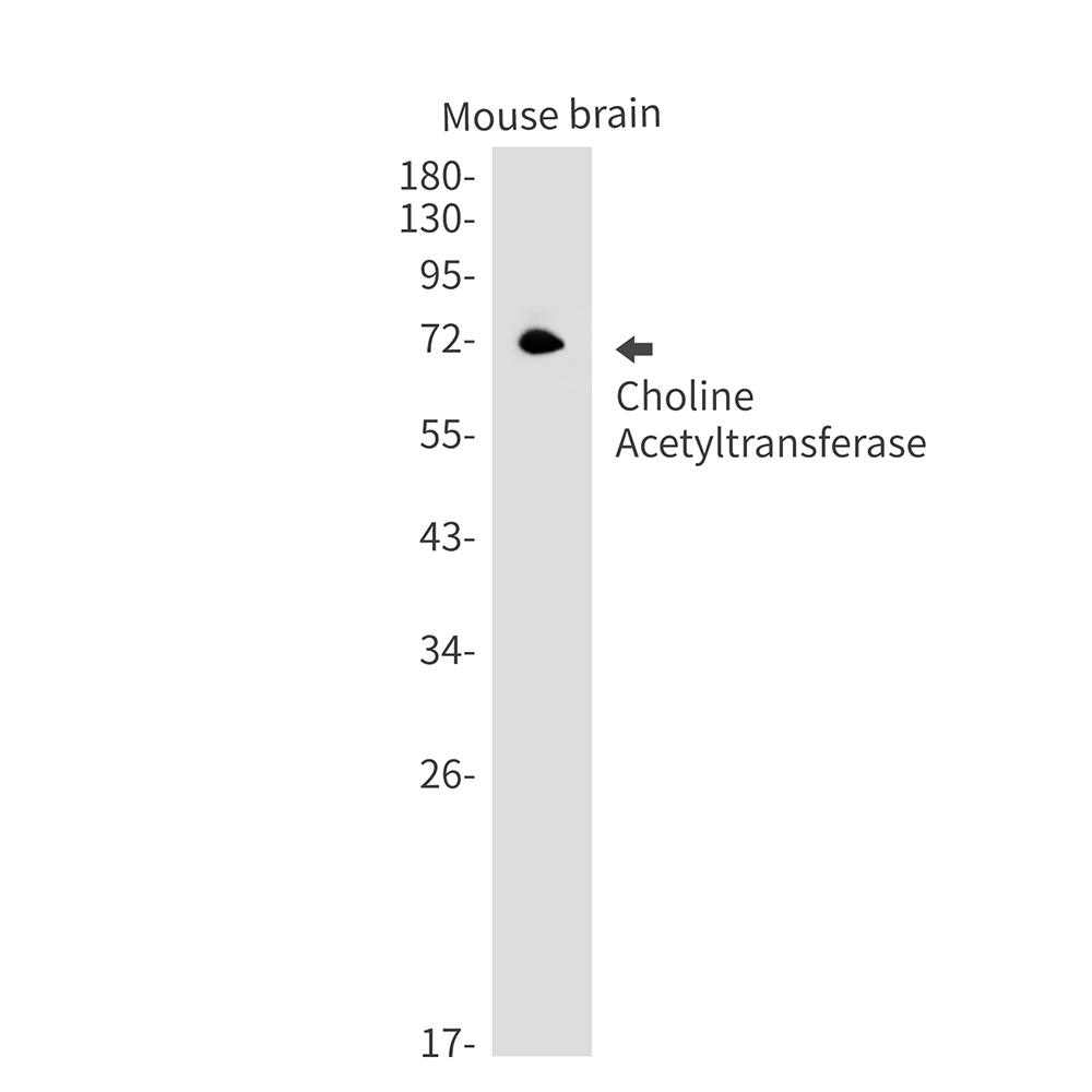 Choline Acetyltransferase Rabbit mAb ABZ2598