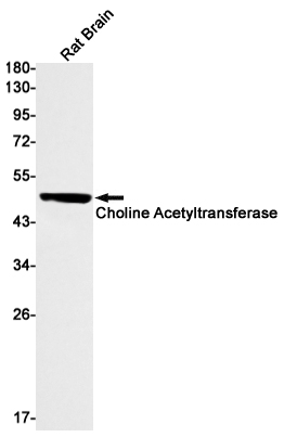 Choline Acetyltransferase Rabbit mAb ABZ2598